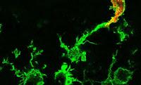 Papel de los Macrófagos  durante un Accidente Cerebro Vascular