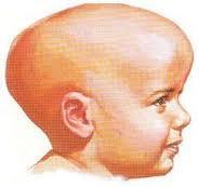 ¿Cuándo se produce la  hidrocefalia?