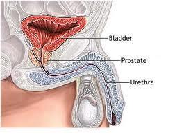 prostatitisb ¿En qué consiste la hiperplasia prostática benigna?