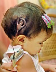 implantecloquear El implante cloquear: una posibilidad de audición