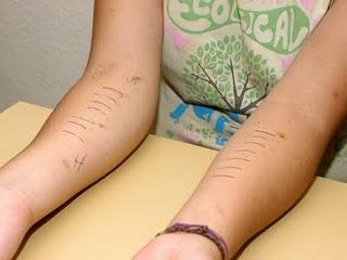 Atiende IMSS casos de rinitis alérgica, que aumentan en esta época del año