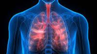 Aumentan las Muertes  debido a Enfermedades Pulmonares