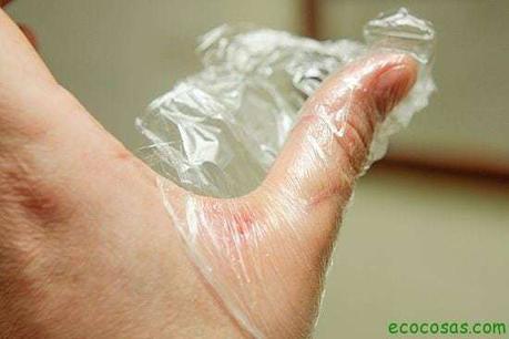 aloe vera quemaduras