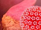 Virus papiloma humano (VPH)