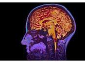 ¿Conoces realmente todo sobre Cerebro Humano?