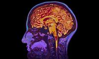 ¿Conoces realmente todo sobre el Cerebro Humano?