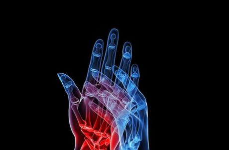 Los análisis clínicos en reumatología Los análisis clínicos en reumatología