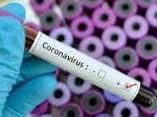 Coronavirus puede sobrevivir minutos aire