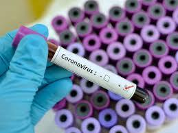 Coronavirus puede sobrevivir 30 minutos en el aire-TuParadaDigital