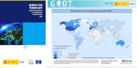 Otra mirada (8) Líderes en trasplantes