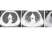 Investigaciones chinas Coronavirus Covid-19