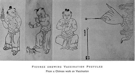 La inoculación de la viruela en la antigua China