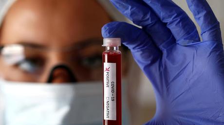 DIARIO DE UNA CUARENTENA (DÍA NUEVE) DIARIO DE UNA CUARENTENA (DÍA NUEVE)