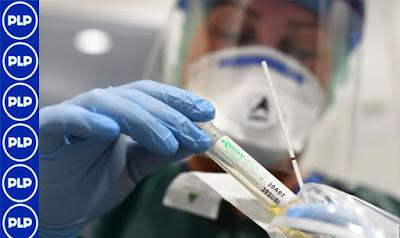 “LAS PRUEBAS RÁPIDAS SE SEGUIRÁN USANDO EN EL PERÚ”...