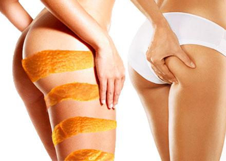 Celulitis: Recomendaciones Básicas y no tan Básicas.