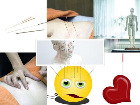 acupuntura acupuntura