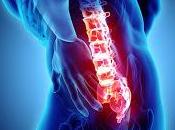 Microdiscectomía mejor para dolor Ciático Crónico