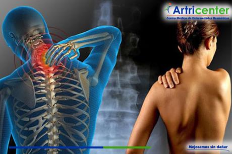 Consejos para evitar la sobrecarga del aparato locomotor en los pacientes con fibromialgia