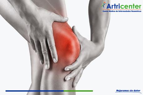 ¿Es la artrosis un problema de salud?
