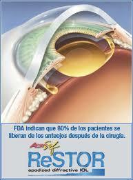 images Una solución integral que corrige el astigmatismo y la presbicia