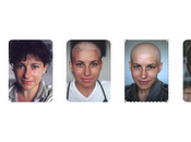 leucemia mujer