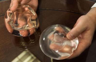 Los implantes de pecho no son para toda la vida