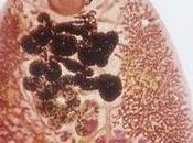 parásito ataca hígado afecta personas España