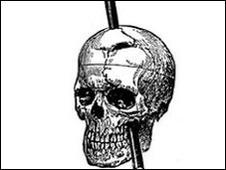 El hombre que vivió con un agujero en la cabeza