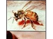 Picaduras insectos, ¿cómo tratan?