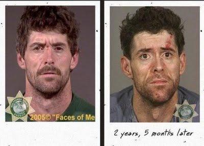 Antes y después del consumo de drogas.