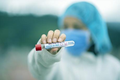 Preocupaciones en test de coronavirus de nueva generación da una esperanza