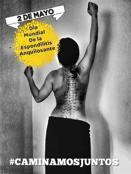 ESPONDILITIS ANQUILOSANTE: CONFINAMIENTO ETERNO