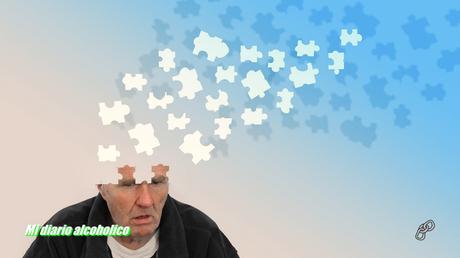 Se me olvidan las cosas Se me olvidan las cosas