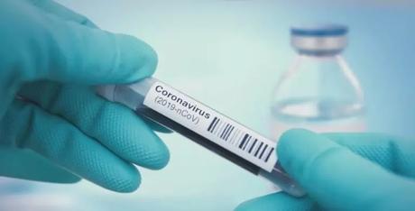 Por coronavirus, mortalidad en RD, 4.17%; en EEUU, 5.84%; en NY, 6%; mundo, 7%.