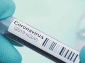 coronavirus, Mortalidad R.D, 4.10%; A.L., 5.39%; Mundo, 6.91%.
