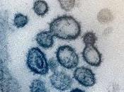 Virus causa COVID-19 puede encontrar Semen