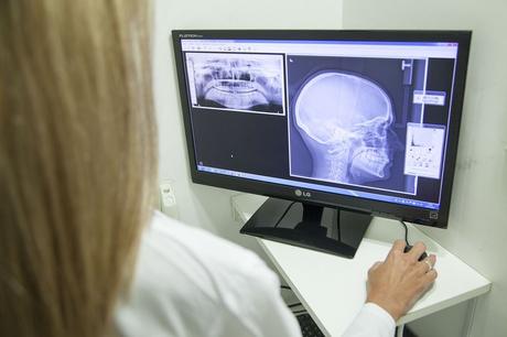 Idonia explica la idoneidad de entregar las pruebas al paciente de manera instantánea