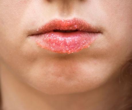 Exfoliante casero de miel y azúcar