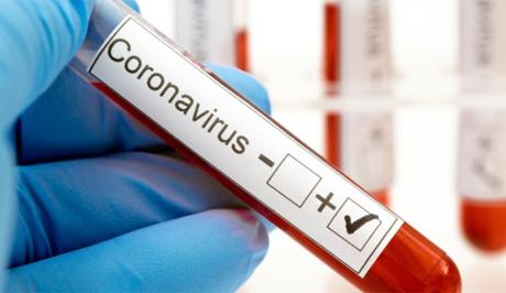 Seroplevalencia, ELISAS y expansión asintomática Seroplevalencia, ELISAS y expansión asintomática