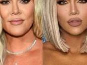 Khloé Kardashian cambió rostro dejó todos shock