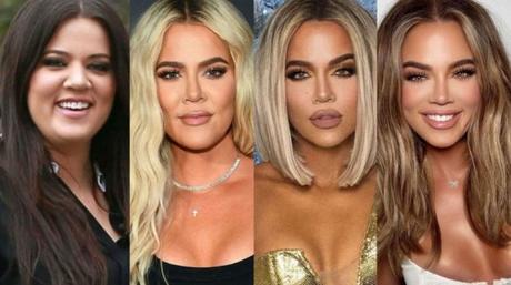 Khloé Kardashian cambió su rostro y dejó a todos en shock Khloé Kardashian - antes y después