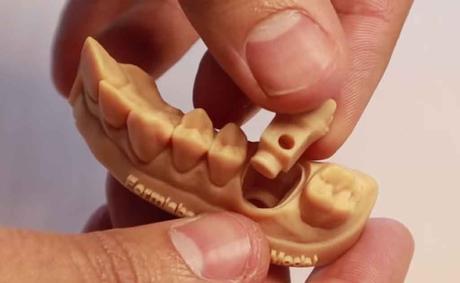resina-biocompatible-dental usos impresora 3d