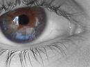 Degeneracion Macular