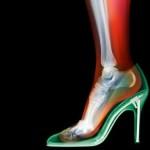 a-x-ray-fashion-9