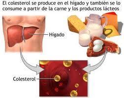 dislipidemias Dislipidemias y problemas con las grasas