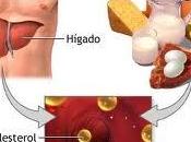 Dislipidemias problemas grasas