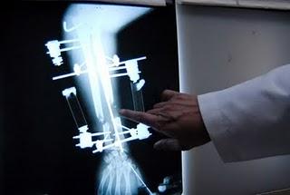 Promueve IMSS cultura contra accidentes