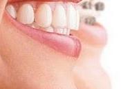 Luce boca perfecta