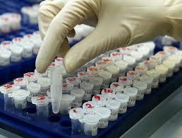 Test de ADN para conocer el riesgo de contraer enfermedades