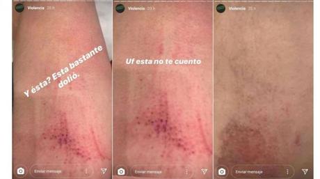 Miss Bolivia y su denuncia por violencia de género